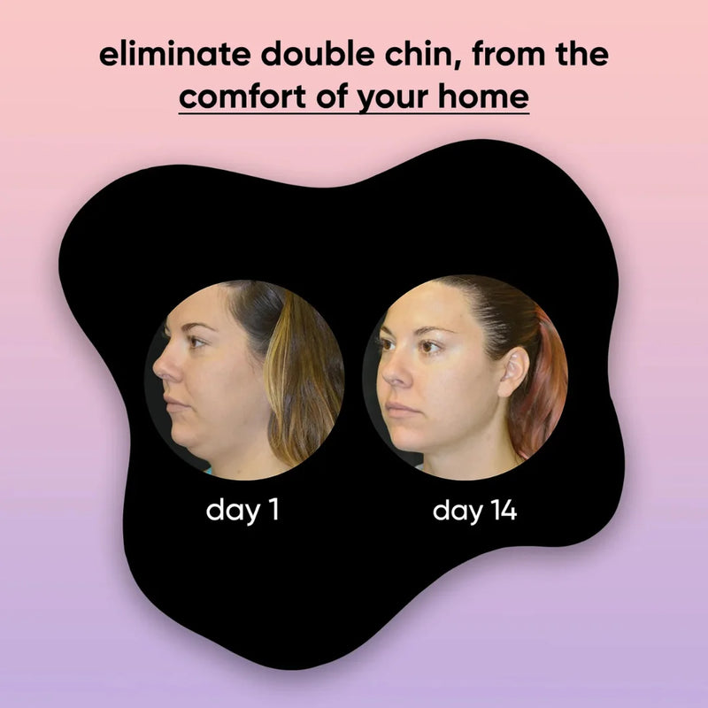 ShapeLift Face Sculptor
