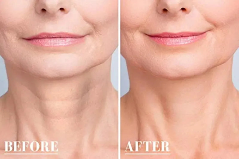 Wrinkle Smoothing Face Patches